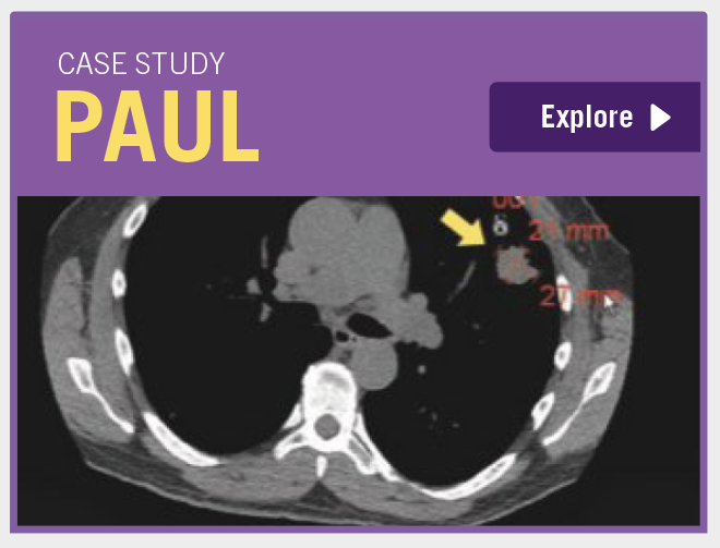 Case study Paul