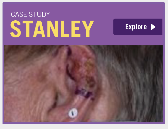 Case study Stanley