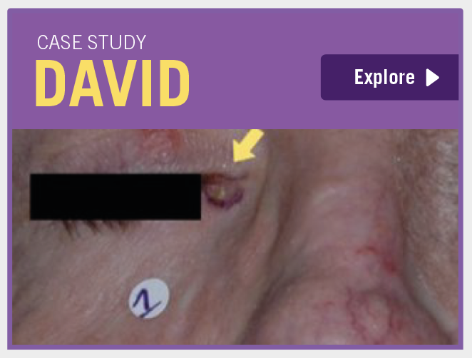 Case study David